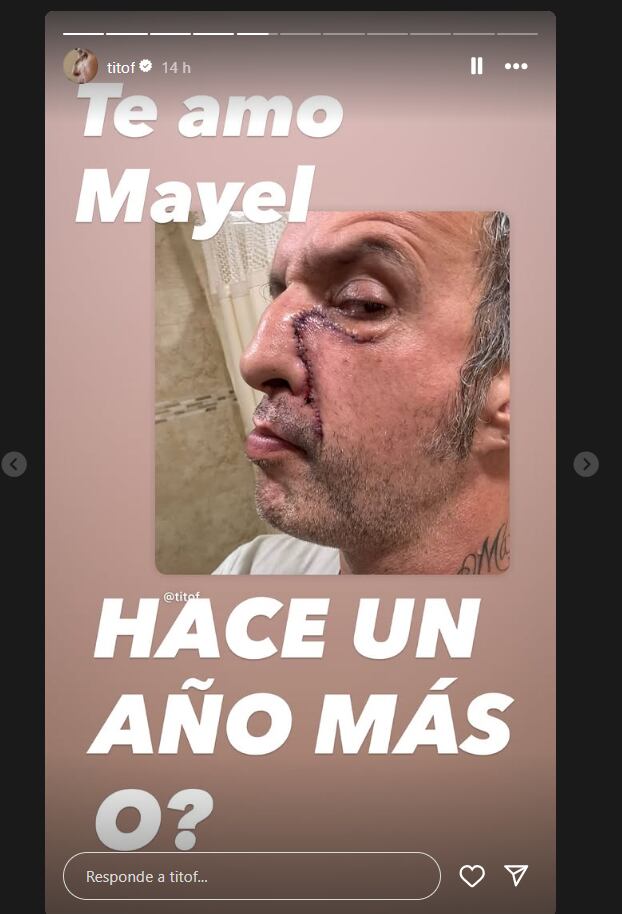 Tito Fuentes sobre su salud. (Instagram: titof)