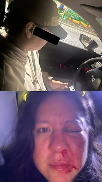 Díptico. Arriba: hombre de perfil con gorra dentro de un coche. Abajo: rostro de mujer con ojo hinchado, nariz y boca con sangre