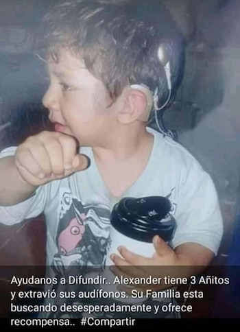 Alexander Implante coclear