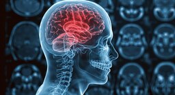 Cuáles son los efectos del cannabis en el cerebro: siete conclusiones de los estudios más recientes