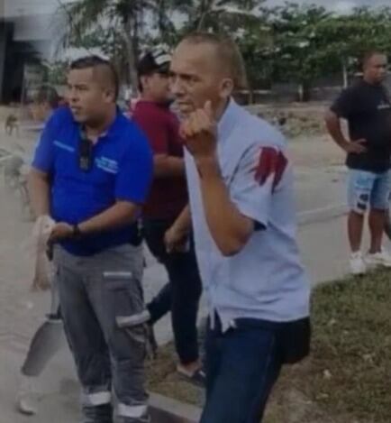 El chofer agredido, identificado como Evaristo Caraballo, sufrió heridas en brazos, manos y piernas, aunque está fuera de peligro - crédito Captura @noticiasyabq/X