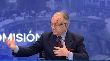 Horacio Embón sorprendió al presentarse con heridas en televisión: “Gracias a los que se han preocupado”