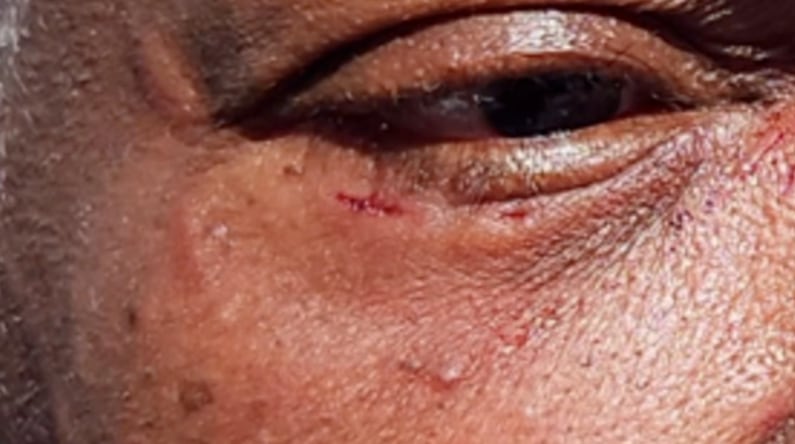 La intervención de una testigo de avanzada edad dejó como saldo marcas visibles en el rostro y la necesidad de atención médica (Orlando Police Department)