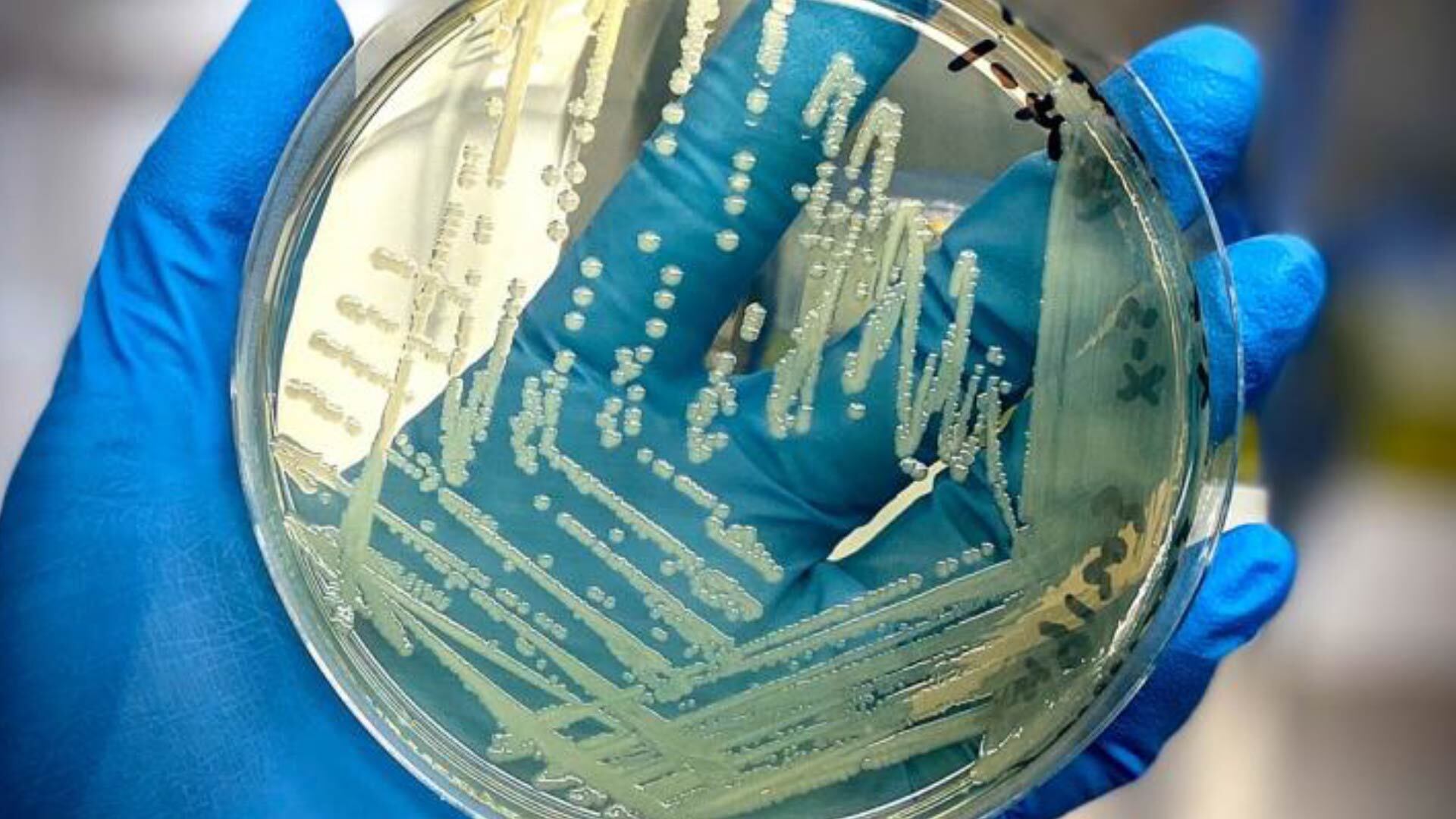 La salmonela tiene la capacidad de sobrevivir en células inmunológicas como los macrófagos. Puede afectar la respuesta a los antibióticos (Mars Global Safety Food Center)