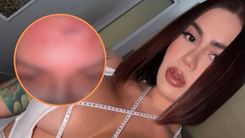 Cintia Cossio compartió imagen de fuerte lesión en su cara: “Pasaron cositas”