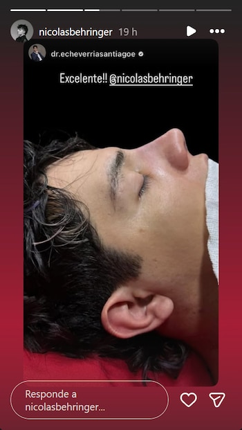 Luego de vender el auto