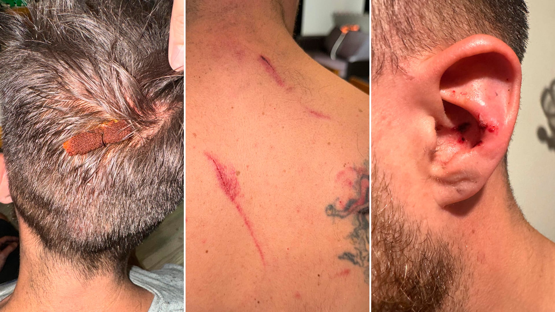 Gallo terminó con una herida en la cabeza, cortes en la oreja y rasguños en la espalda tras el ataque de su ex