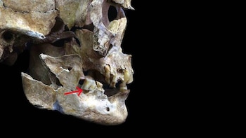 Investigadores reconstruyen el rostro de una mujer de 3.600 años del antiguo Japón usando su muela
