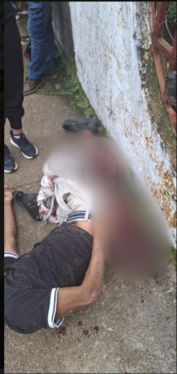 Hombre pierde el pie por perros al parecer en Mitú - crédito Colombia Oscura / X