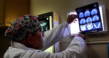 El tumor no solo dañaba