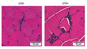 Imagen K5UASBRE7FD57GDPEXF4K4KDC4