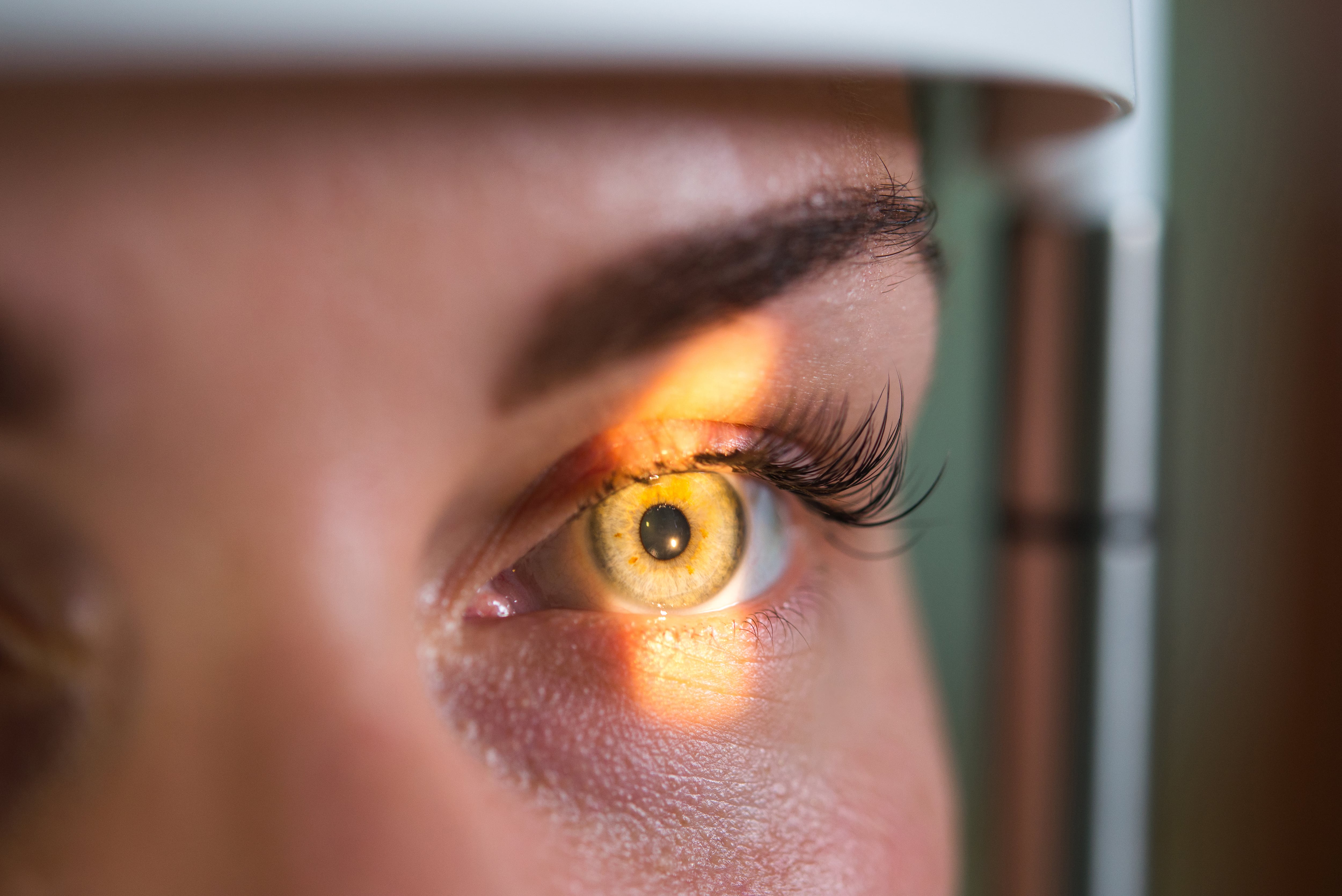 Las mujeres mayores de 40 años presentan un mayor riesgo de glaucoma, siendo fundamentales los controles oftalmológicos periódicos para prevenir la ceguera irreversible. (Shutterstock)