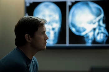 Una de las primeras imágenes