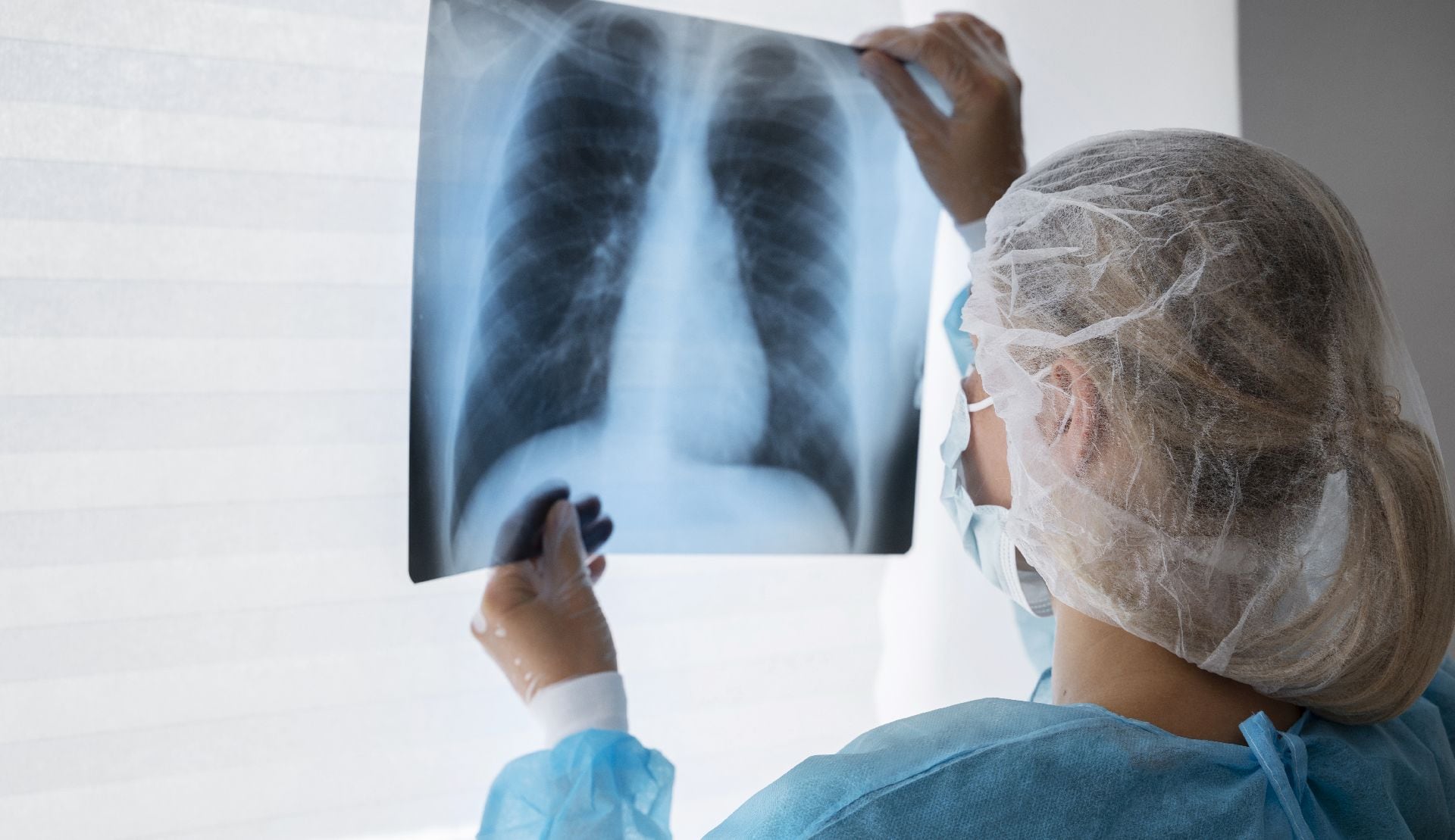 La neumonía atípica representa una amenaza silenciosa en entornos cerrados y en poblaciones vulnerables, por su fácil transmisión (Freepik)