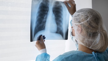 Neumonía atípica: en qué se