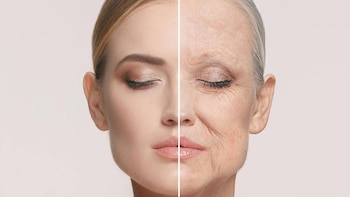 No hay acuerdo de especialistas