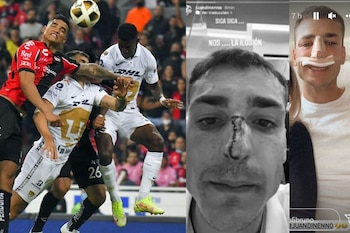 Anderson Santamaría provocó fractura de Juan Dinenno (Fotos: Agencias | Instagram | Twitter)