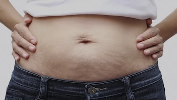 Es una consecuencia común de