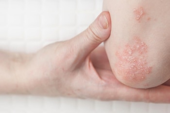 Imagen KDMIT722RVADJEZ34SED3POYWI