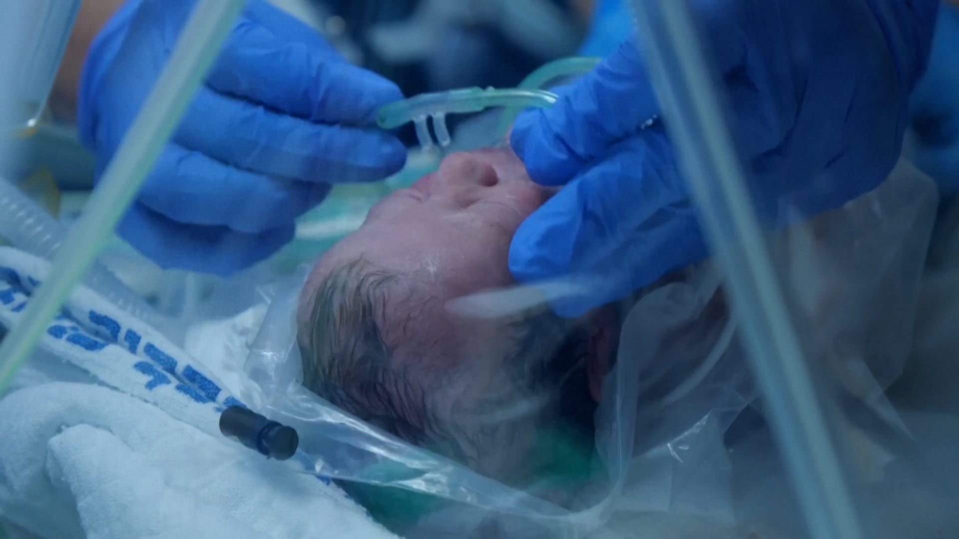 Trillizas nacidas bajo fuego: una mujer dio a luz en un hospital subterráneo de Israel en medio de los bombardeos iraníes