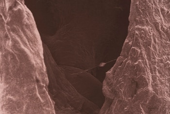 Peau #5. Série: Une tentative