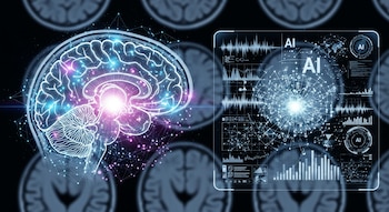 BrainIAC utiliza inteligencia artificial para
