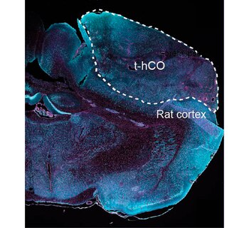 Pasca y su equipo creó