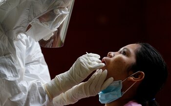 La rápida detección de los