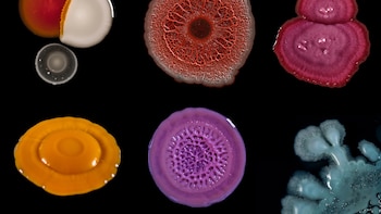 Al rescate de un antibiótico ‘olvidado’: un medicamento de los años 80 demuestra su eficacia contra las superbacterias