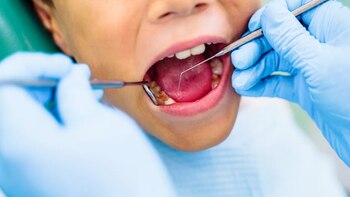 Le debían extraer una muela,