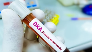 Impulsan campaña nacional para concientizar