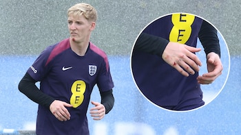 Las lesiones de Anthony Gordon