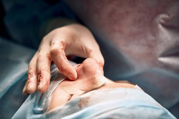 Pacientes denuncian al médico tras una disputa por el resultado de una rinoplastia realizada en un entorno no quirúrgico - crédito iStock