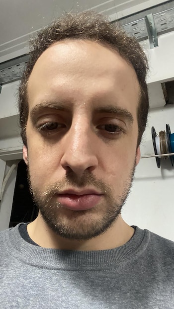 A pesar de lo vivido,