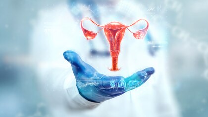 El 80% de los casos de cáncer de ovario se detectan en etapas avanzadas 