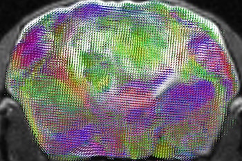 Imagen de resonancia magnética transversal de un cerebro de ratón xenocortical que muestra un mapa de las vías y direcciones estimadas de las fibras nerviosas (foto: Laboratorio Pasca, Universidad de Stanford)
