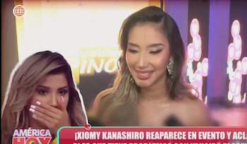 Kanashiro reiteró que no responde