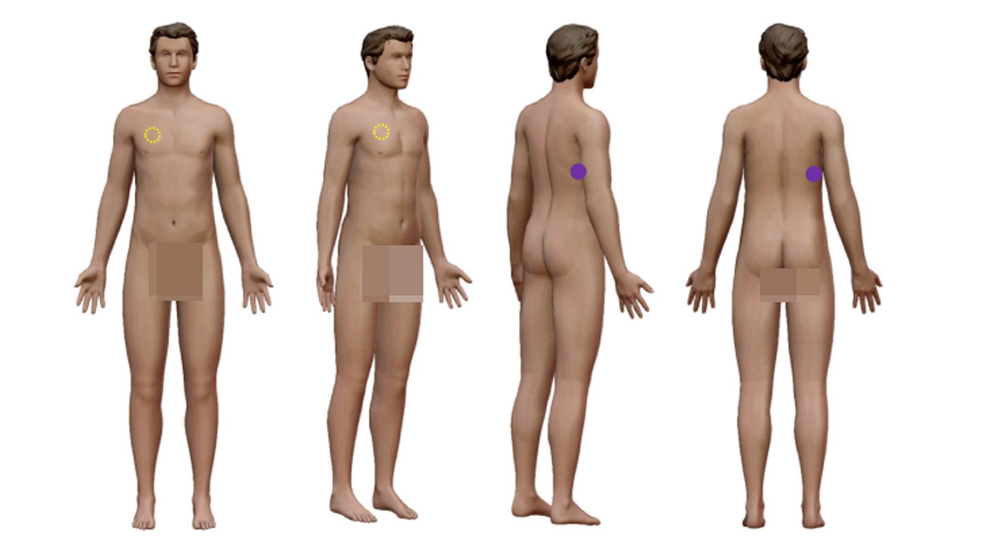 Croquis forense: el trayecto de la bala que mató al ladrón menor de edad