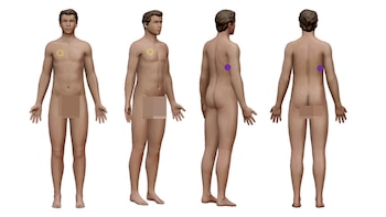 Croquis forense de la causa: