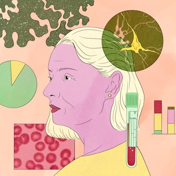 Two blood biomarker tests for AlzheimerÕs were approved by the Food and Drug Administration last year to help diagnose people who are experiencing cognitive impairment. More and more, people without memory problems are taking the tests, as well, to try to determine whether they will develop AlzheimerÕs in the future. (Michelle Mildenberg/The New York Times) Ñ FOR EDITORIAL USE ONLY WITH NYT STORY SCI ALZHEIMERS TESTING BY DANA G. SMITH FOR AUG. 12, 2026. ALL OTHER USE PROHIBITED. Ñ