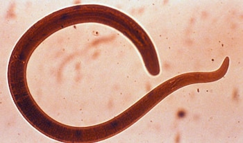 Ascaris lumbricoides