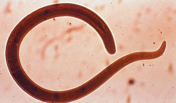Ascaris lumbricoides visto en microoscopio.(Farmacia Las Fuentes)