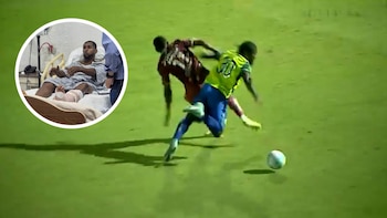 La desesperada reacción de los jugadores tras ver la escalofriante fractura que conmocionó al fútbol de Honduras