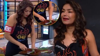 Claudia Portocarrero sufrió corte profundo