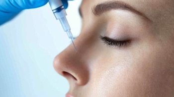 A pesar de la caída