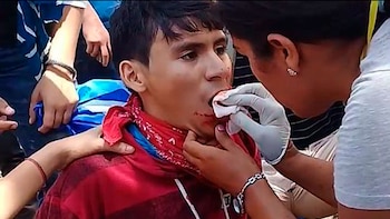 Álvaro Conrado, 15 años, minutos antes de morir a consecuencia de un balazo en el cuello, en abril de 2018.