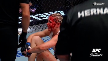 Sangrienta definición en UFC: con un codazo le abrió la cabeza a su rival y ganó un bono de 100 mil dólares