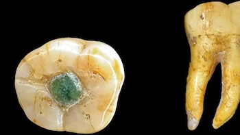 Un estudio documenta la primera incrustación de jadeíta en un molar de la civilización maya en Guatemala