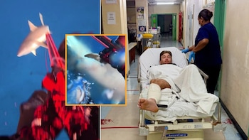 El impactante momento en que un tiburón ataca a influencer mientras pescaba en Fiyi: “Sabía que venía por mí”