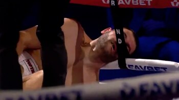 Así terminó Alexandre Kartozia